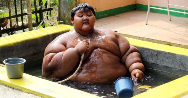 Самый жирный в мире мальчик