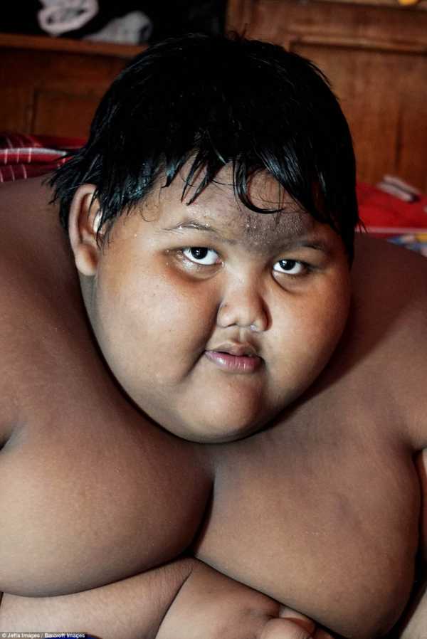 Самый жирный в мире ребенок